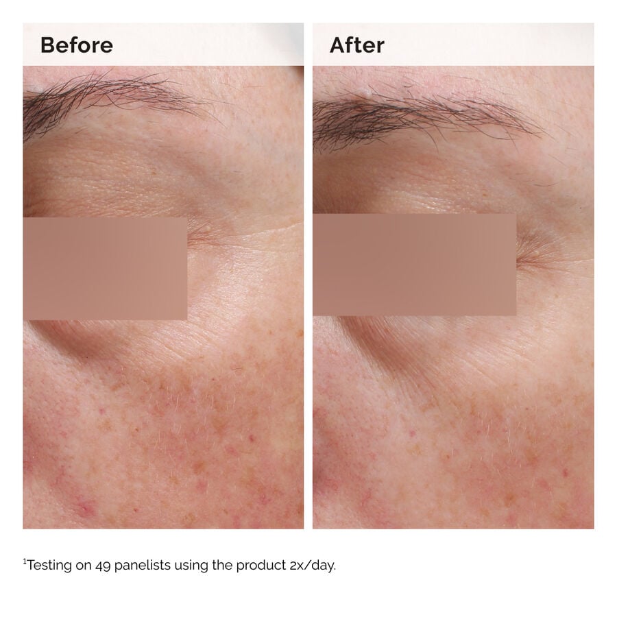niacinamide-5-face-and-body-emulsion-u4 2024-08-23-ORD-Nia-5pct-Face-Body-B-A-Elasticity-Global-02-1x1.jpg