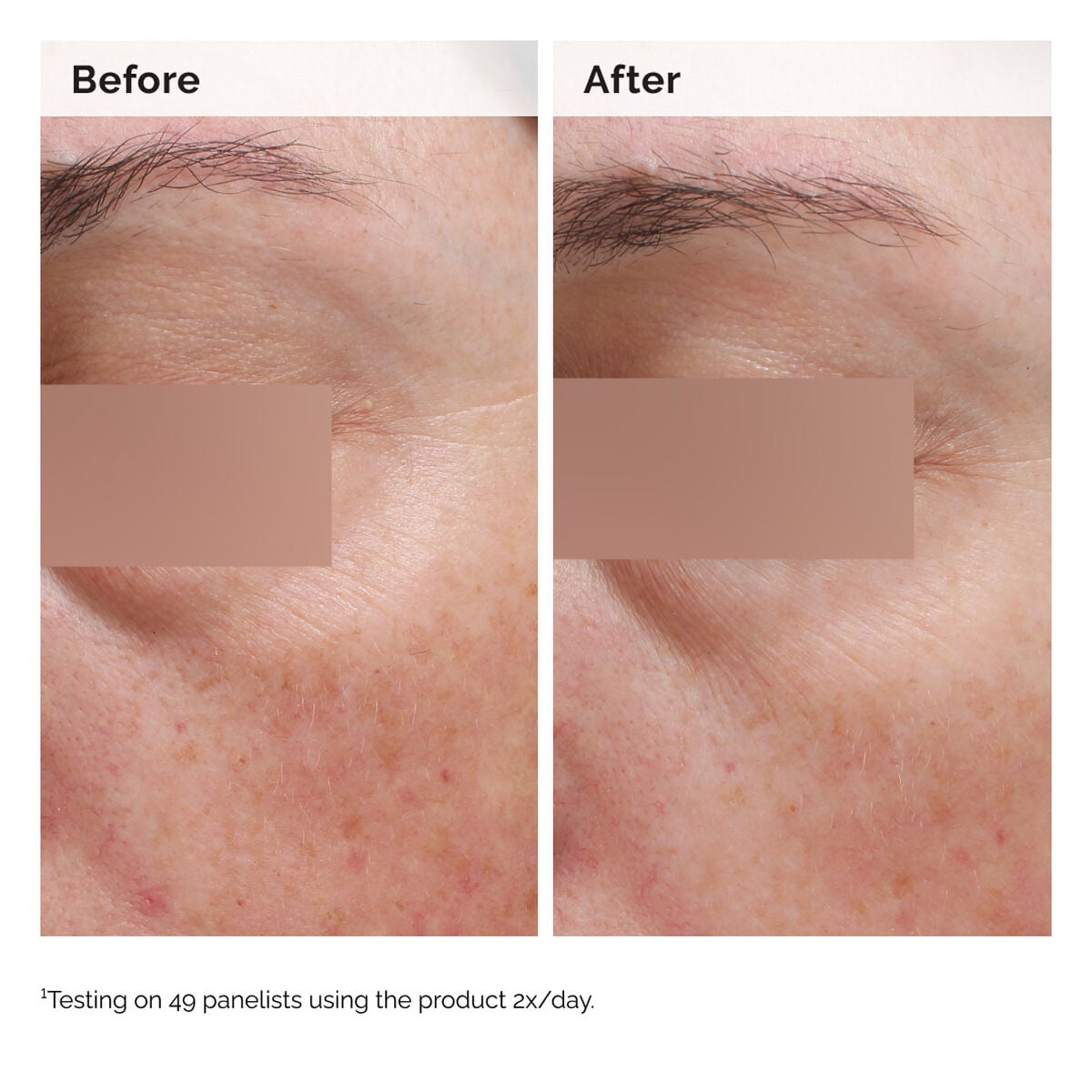 niacinamide-5-face-and-body-emulsion-u4 2024-08-23-ORD-Nia-5pct-Face-Body-B-A-Elasticity-Global-02-1x1.jpg