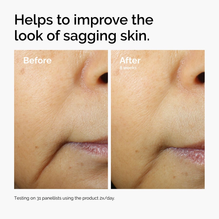 caffeine-3-escin-1-face-serum-a0 ord-caffeine-3pct-escin-1pct-face-serum-before-after-sagging.jpg