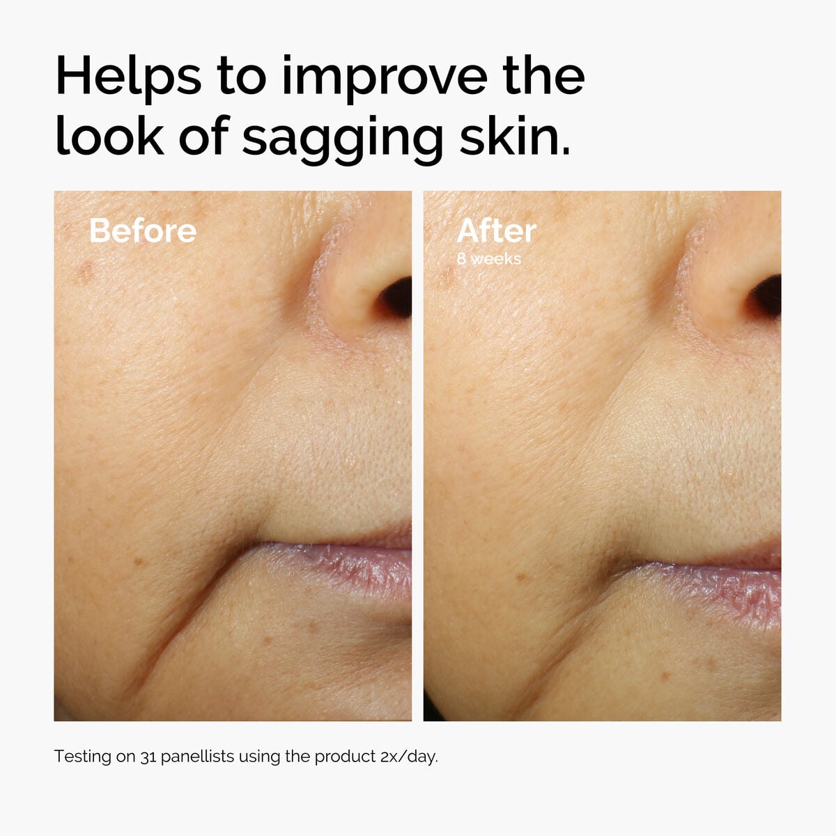 caffeine-3-escin-1-face-serum-a0 ord-caffeine-3pct-escin-1pct-face-serum-before-after-sagging.jpg