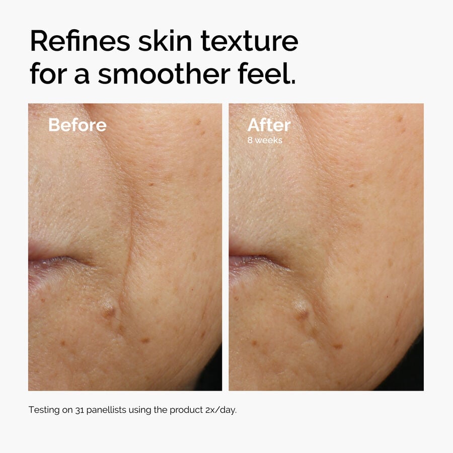 caffeine-3-escin-1-face-serum-a0 ord-caffeine-3pct-escin-1pct-face-serum-before-after-texture.jpg