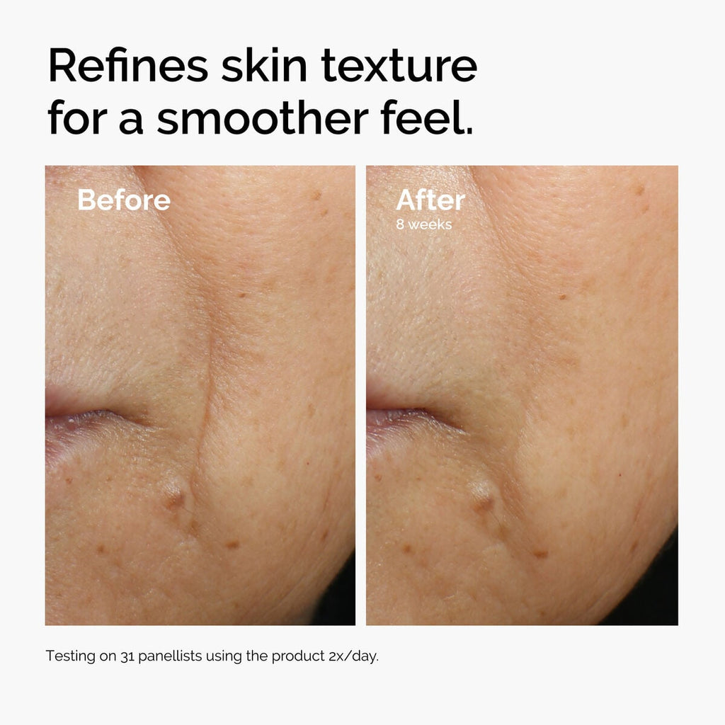caffeine-3-escin-1-face-serum-a0 ord-caffeine-3pct-escin-1pct-face-serum-before-after-texture.jpg