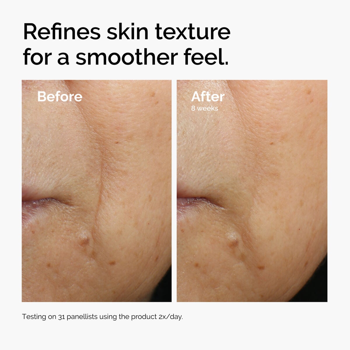 caffeine-3-escin-1-face-serum-a0 ord-caffeine-3pct-escin-1pct-face-serum-before-after-texture.jpg