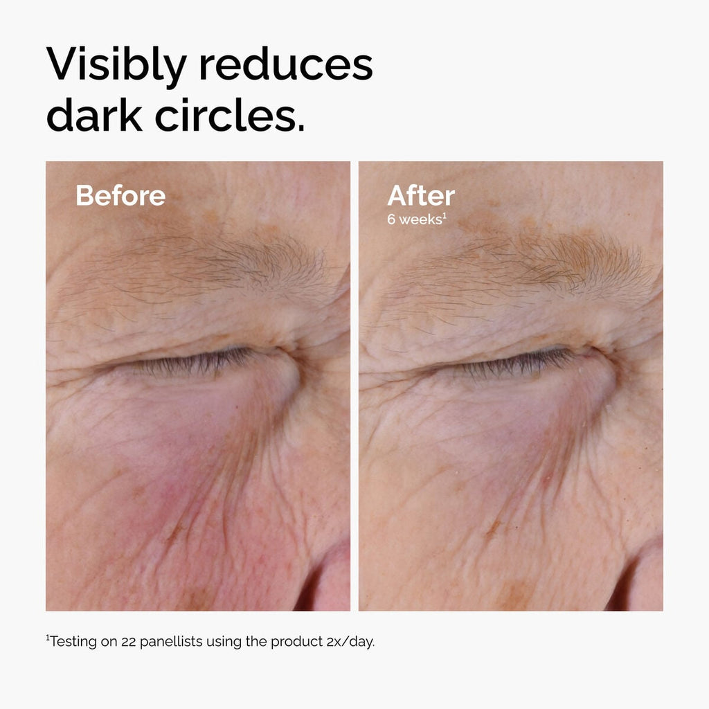 caffeine-solution-5-egcg-eye-serum-p7 ord-caffeine-solution-egcg-dark-circles-before-after.jpg