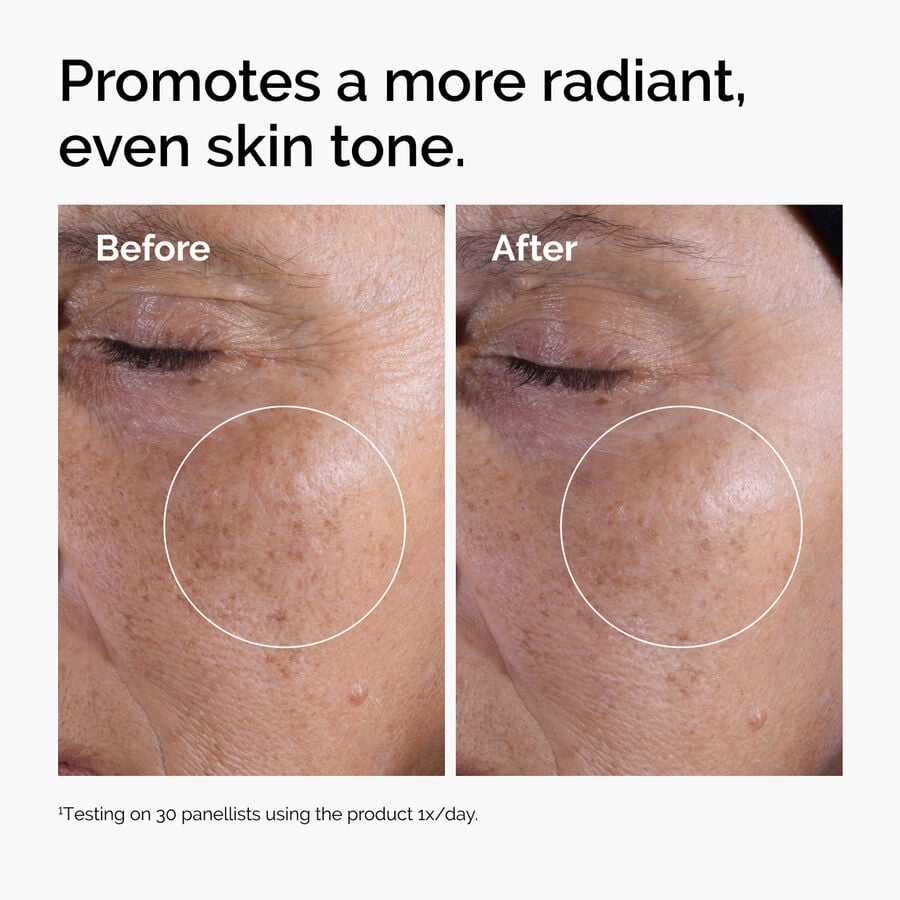 glycolic-acid-7-exfoliating-toner-l7 ord-glycolic-before-after-radiance.jpg