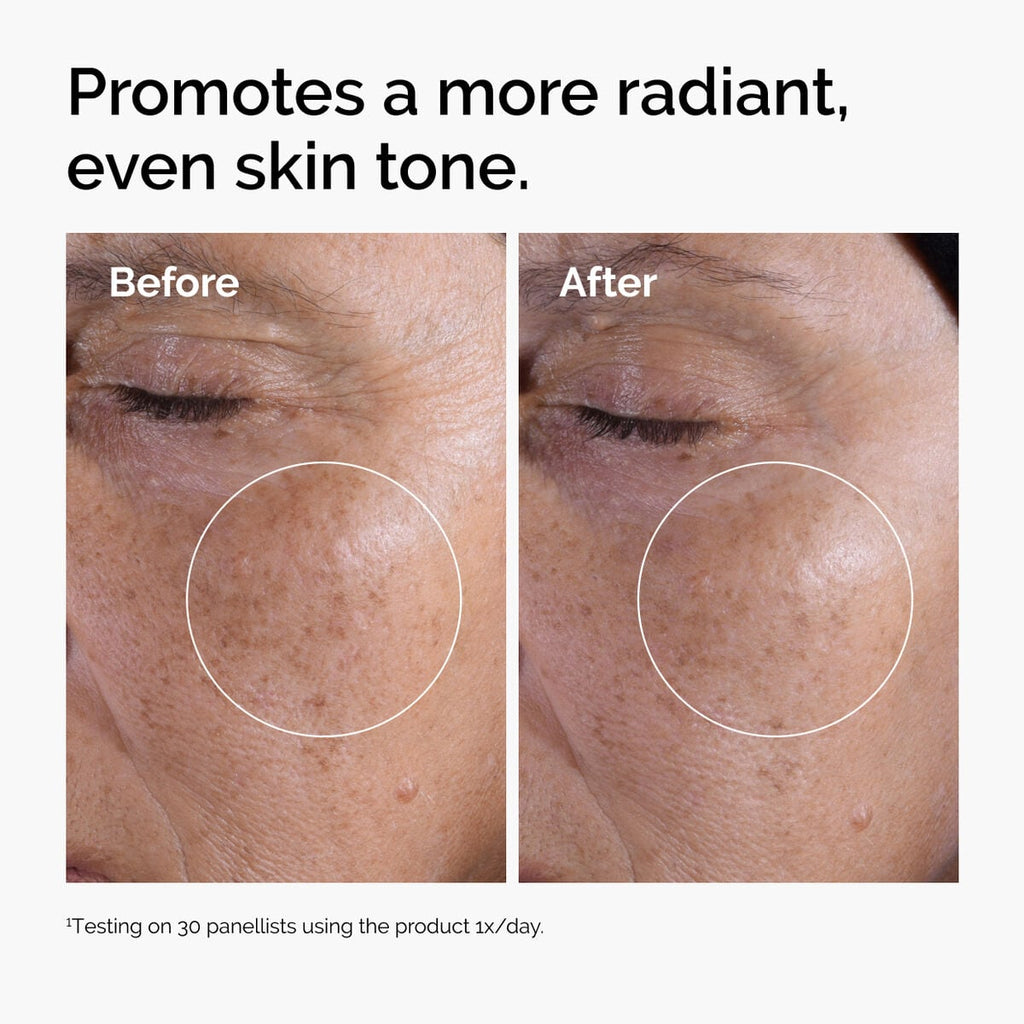 glycolic-acid-7-exfoliating-toner-l7 ord-glycolic-before-after-radiance.jpg