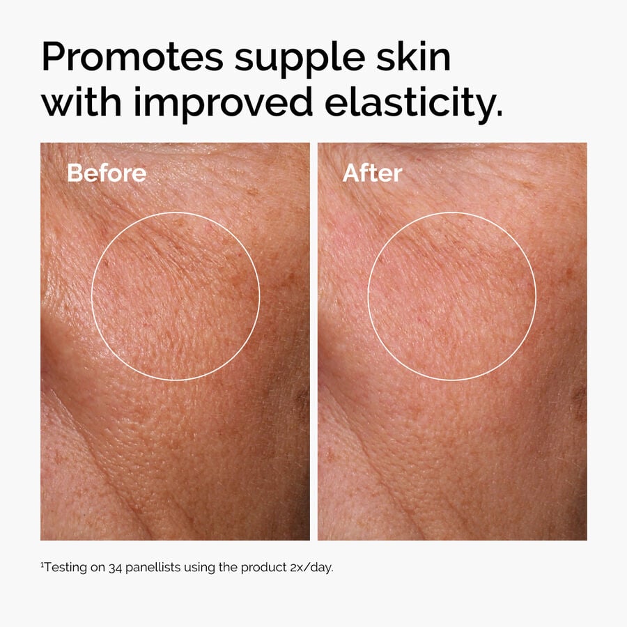 hyaluronic-acid-2-b5-with-ceramides-b3 ord-hyaluronic-acid-2pct-b5-hydrating-serum-before-after-elasticity.jpg