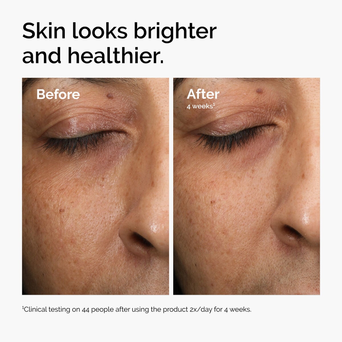 multi-antioxidant-radiance-serum-z8 ord-mars-before-after-healthy.jpg