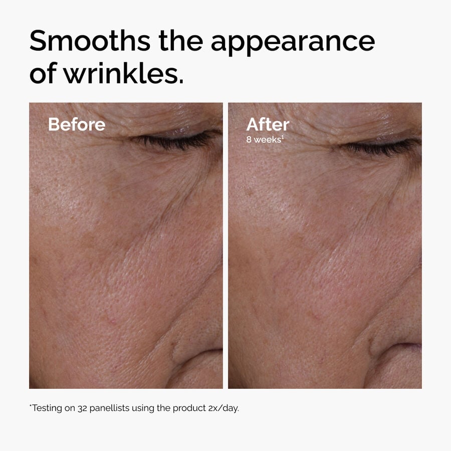 multi-peptide-ha-serum-w6 ord-multi-peptide-ha-serum-wrinkles-before-after.jpg