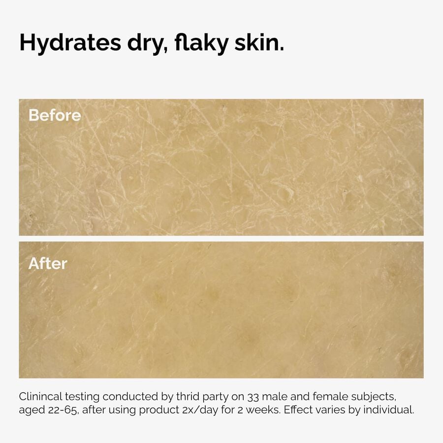 the-body-care-collection-r4 ord-natural-moisturizing-factors-inulin-body-before-after-graphic-02.jpg