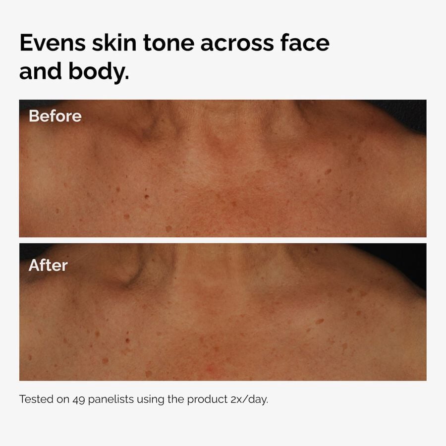 the-body-care-collection-r4 ord-niacinamide-face-body-serum-before-after-even-tone-graphic.jpg