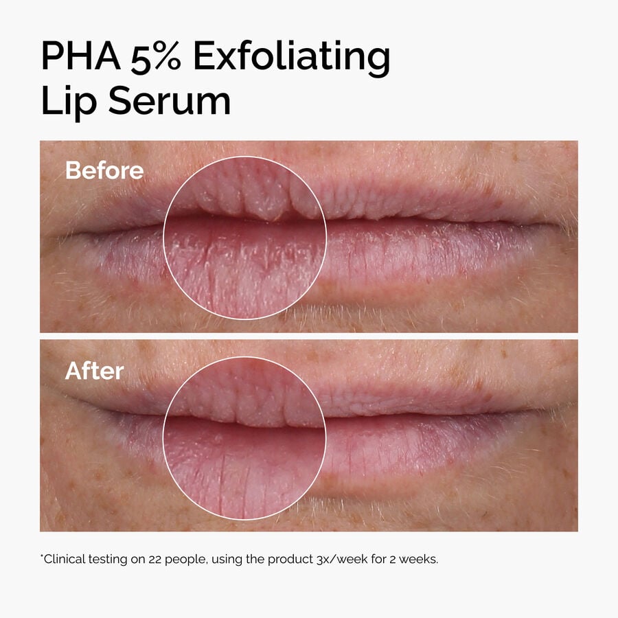 pha-5-exfoliating-lip-serum-t7 ord-pha-5pct-lip-exfoliating-serum-before-after.jpg