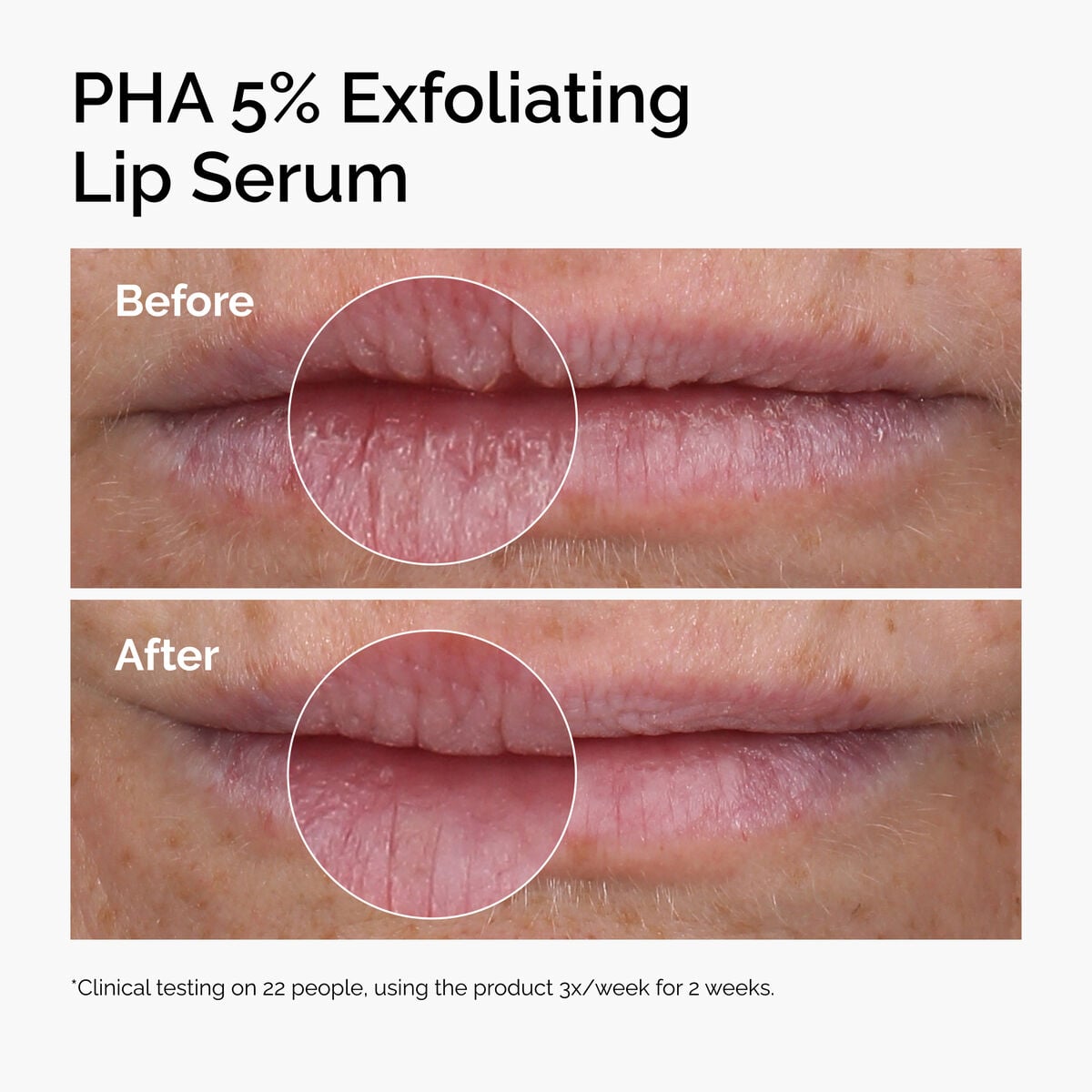 pha-5-exfoliating-lip-serum-t7 ord-pha-5pct-lip-exfoliating-serum-before-after.jpg