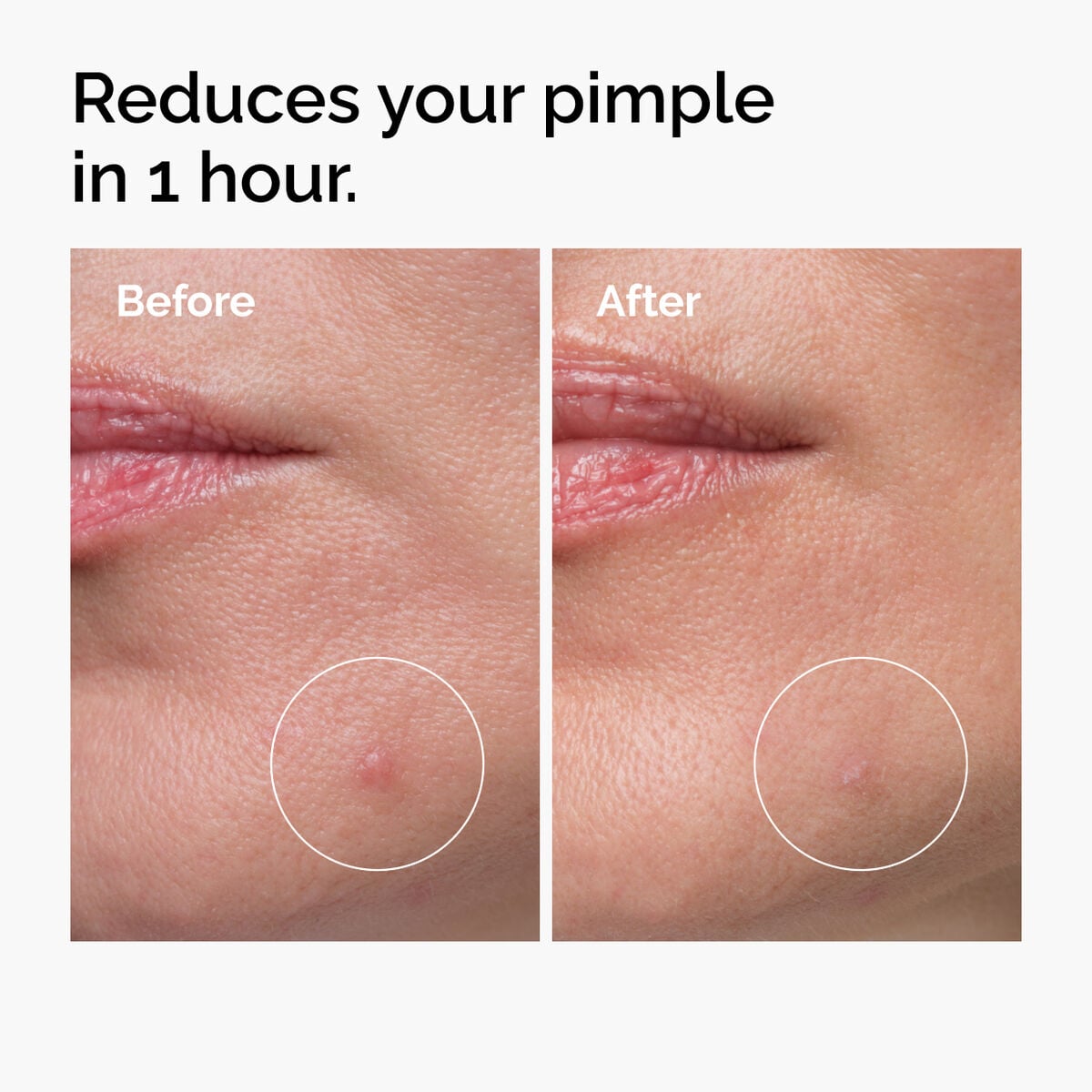 sulfur-10-powder-to-cream-concentrate-g0 ord-sulfur-10pct-powder-to-cream-concentrate-before-after-NA.jpg